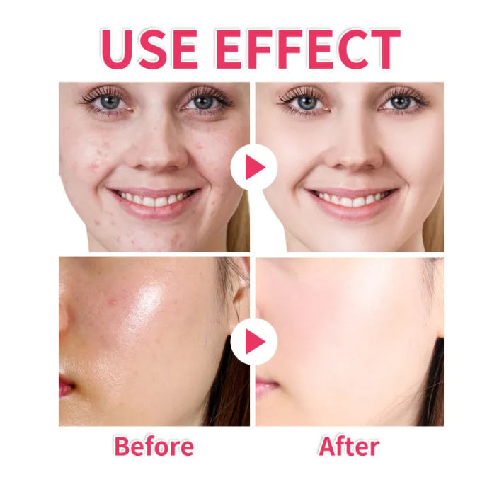 Turmeric Kojic Cleansing Pads – Brightening & Tone-Evening Exfoliation